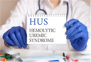 Diagnosis and Treatment of HUS in Rochester