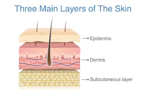 Main layers of the skin