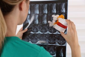 7-28-26-How-Mjuch-is-a-Herniated-Disk-Worth-300x200