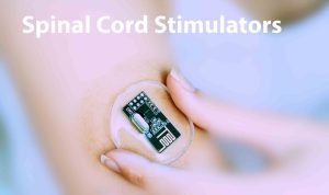 10-14-26-Spinal-Cord-Stimulator-lawsuit-300x178