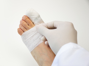 Injuried Feet