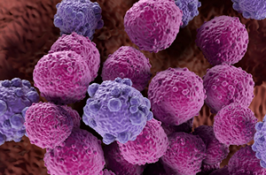 The Requirements For Filing A Dupixent Cancer Lawsuit