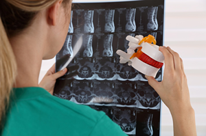 2. Slipped And Herniated Disks 