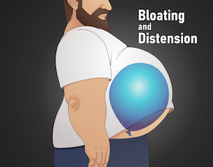 Bloating and Distension