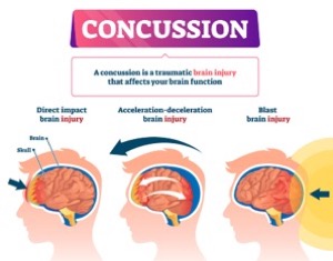 Top Ranked Concussion Injury Attorneys In Rochester
