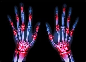 Hands X-Ray