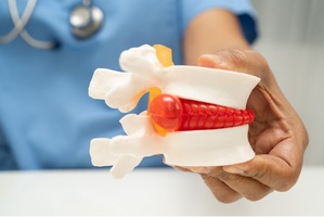 What is a herniated Disk worth