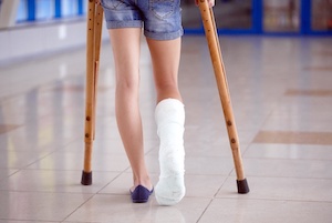 Person with a broken leg