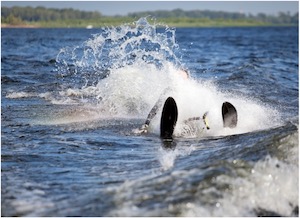 Serious Injuries Associated With Waterskiing