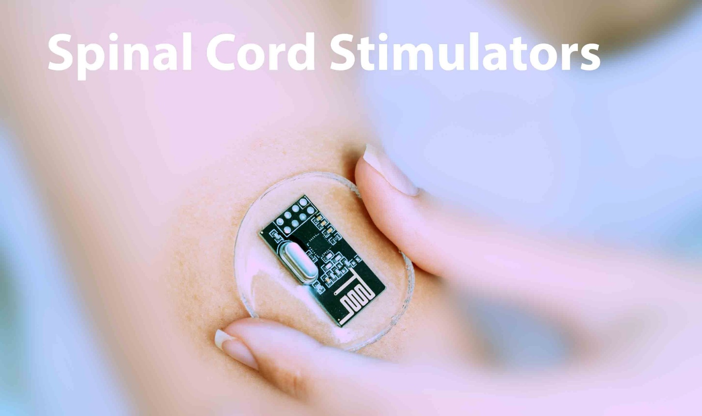ALBANY SPINAL CORD STIMULATOR LAWSUITS