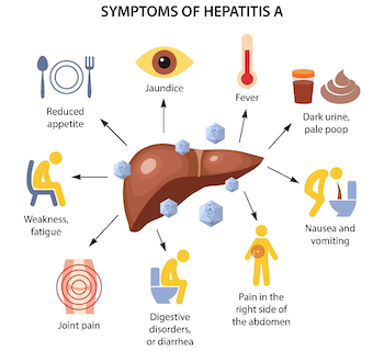 Symptoms hepatitis a