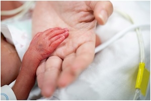 Syracuse, New York, Pregnant Woman Car Accidents