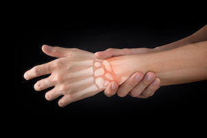 Syracuse Wrist Injury